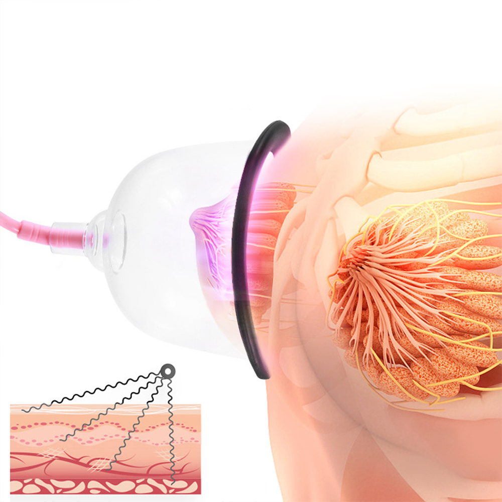 เครื่องนวดสุญญากาศไฟฟ้าถ้วยดูด - Breast Pump บทวิจารณ์และราคา