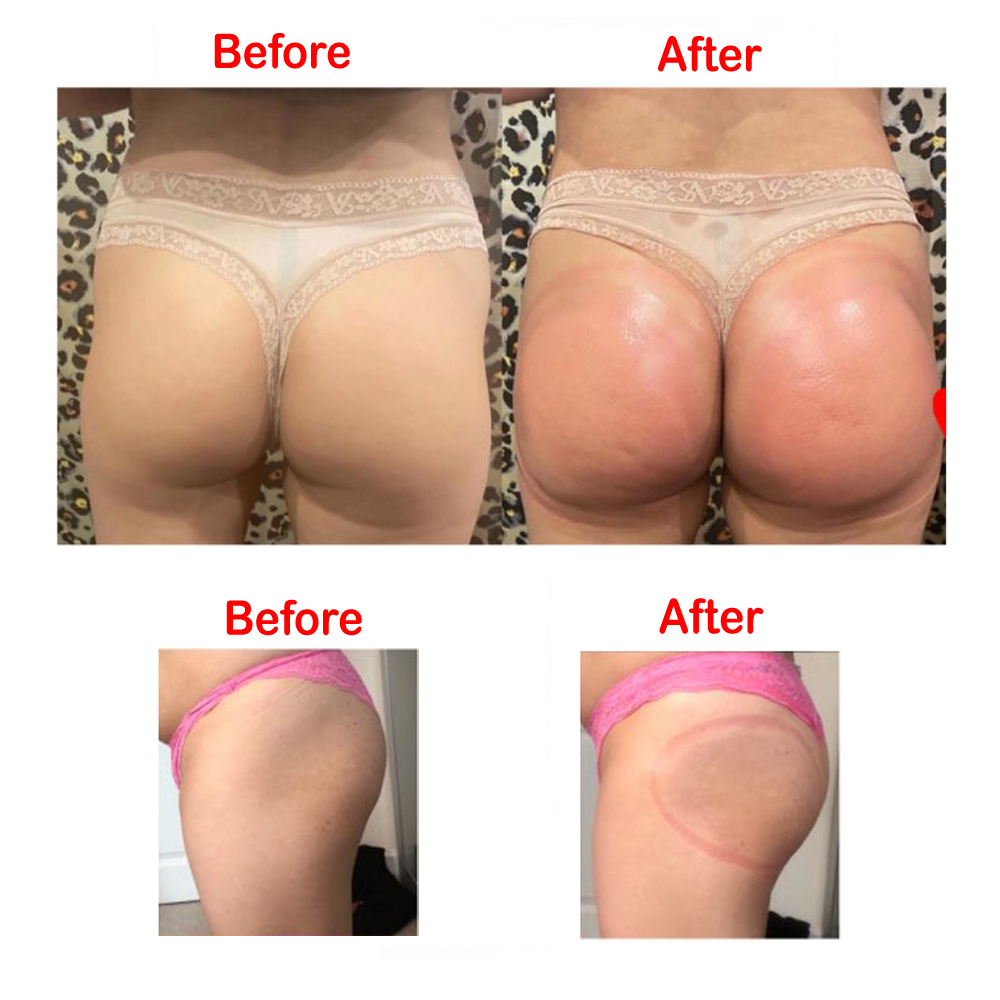 VamsLuna 2 ชิ้น 21 ซม. ขนาด Bu - Breast Pump บทวิจารณ์และราคา